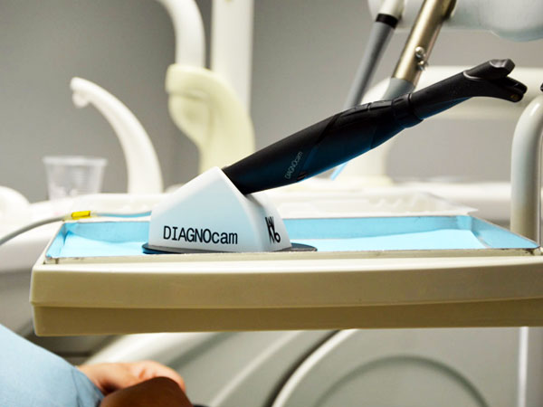 Diagnocam: il moderno dispositivo dentistico per rivelare le carie precocemente